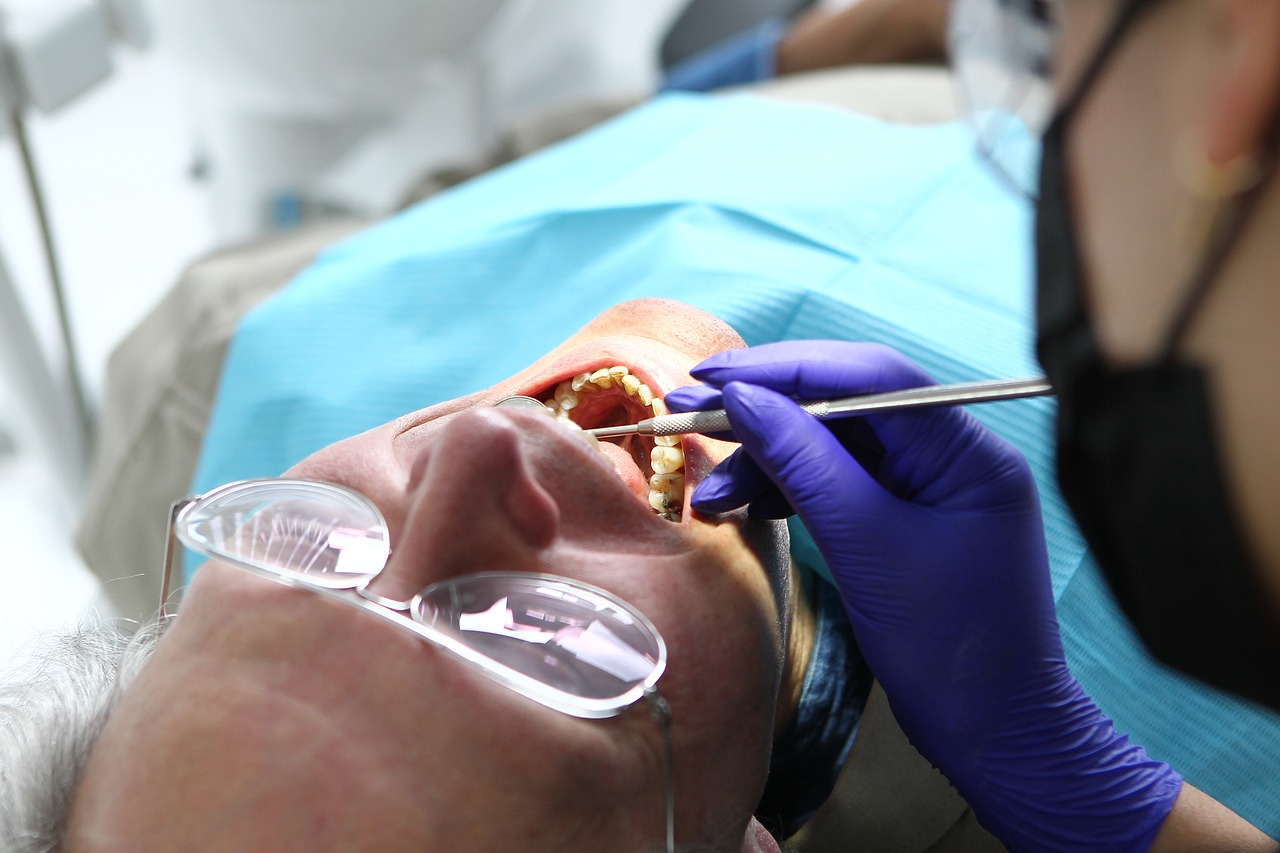 Na fotografiji je osoba koja leži dok joj stomatolog u plavim rukavicama pregledava zube. Osoba ima naočale i prekrivena je plavom zaštitnom plahtom. Stomatolog obavlja pregled ili rad na pacijentovim otvorenim ustima pomoću alata. Okruženje izgleda kao dobro osvijetljena profesionalna stomatološka ordinacija ili klinika.