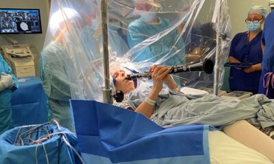 Fotografija prikazuje ženu koja svira klrinet dok joj liječnici rade operaciju na mozgu.