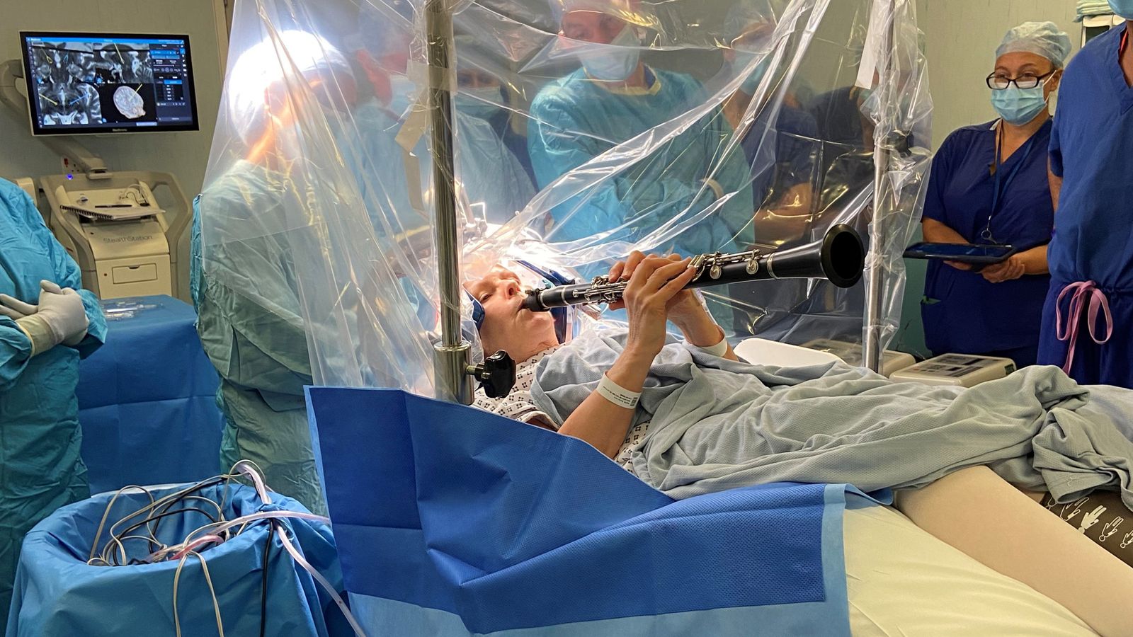 Fotografija prikazuje ženu koja svira klrinet dok joj liječnici rade operaciju na mozgu.
